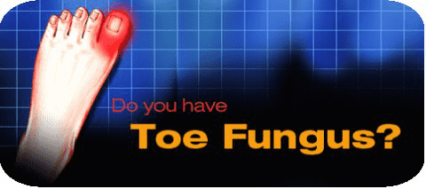 Can You Get Toe Fungus From Bowling Shoes?