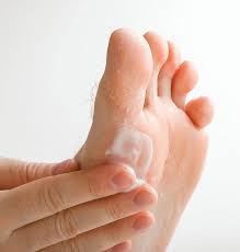 Treatment For Athlete's Foot